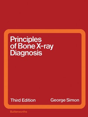cover image of Principles of Bone X-Ray Diagnosis